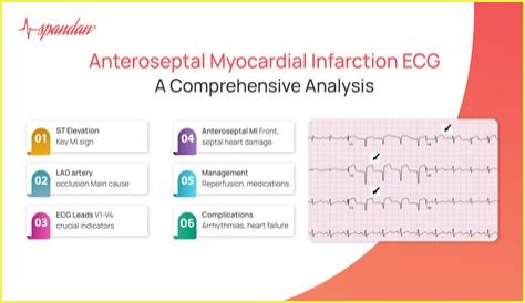 What does the medical term infarct mean?