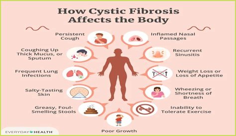 What is Fibrositis pain?